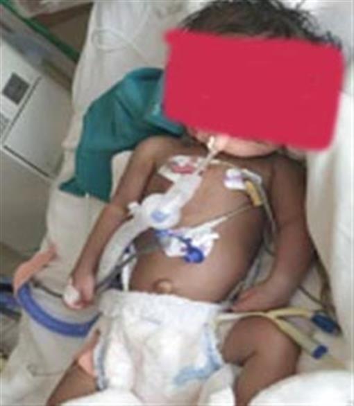 कोरोना से 6 माह की मासूम ने दमतोड़ा, परिजनों समेत 54 स्‍वास्‍थ्‍य कर्मियों की रिपोर्ट आई ने‍गे‍टिव
